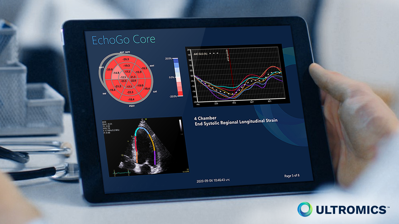 A cardiologist reviewing the results of a Strain report from Ultromics' EchoGo on a tablet