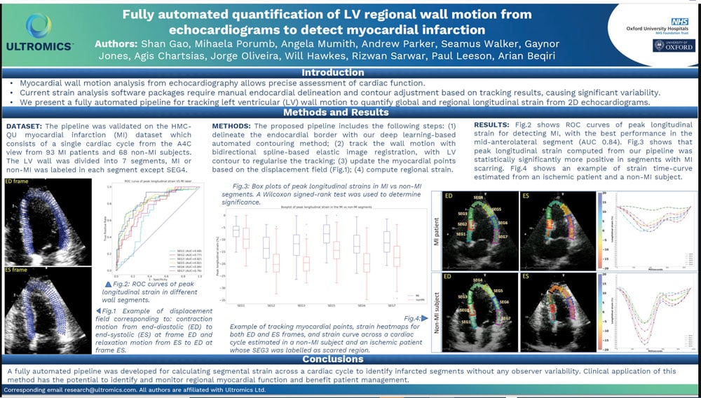 Fully-automated--quantification-of-LV-regional-wall-motion-from--echocardiograms-to-detect-myocardial-infarction