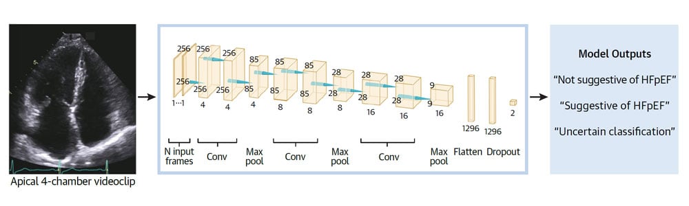 ASE-model-image