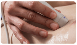 Diagnosing HFpEF thumbnail
