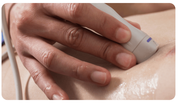 Diagnosing HFpEF thumbnail