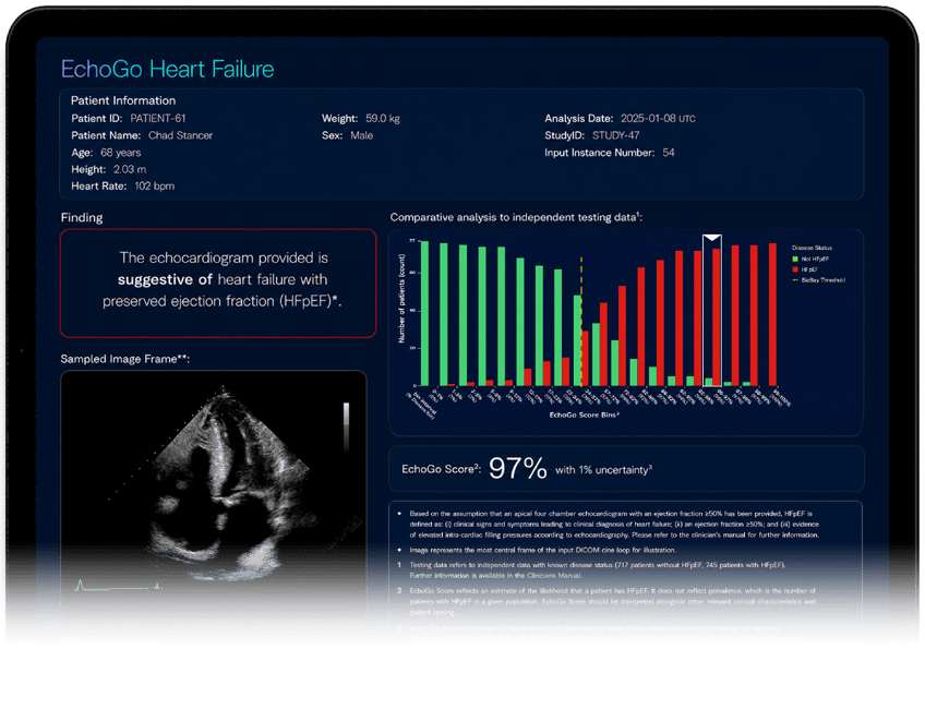 ECG-HF-2.0-clean-frame