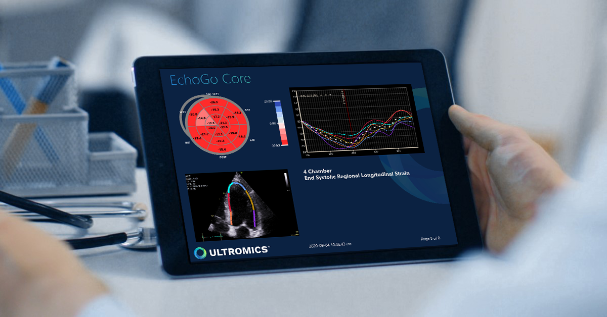 Echogo Core report seen on a tablet