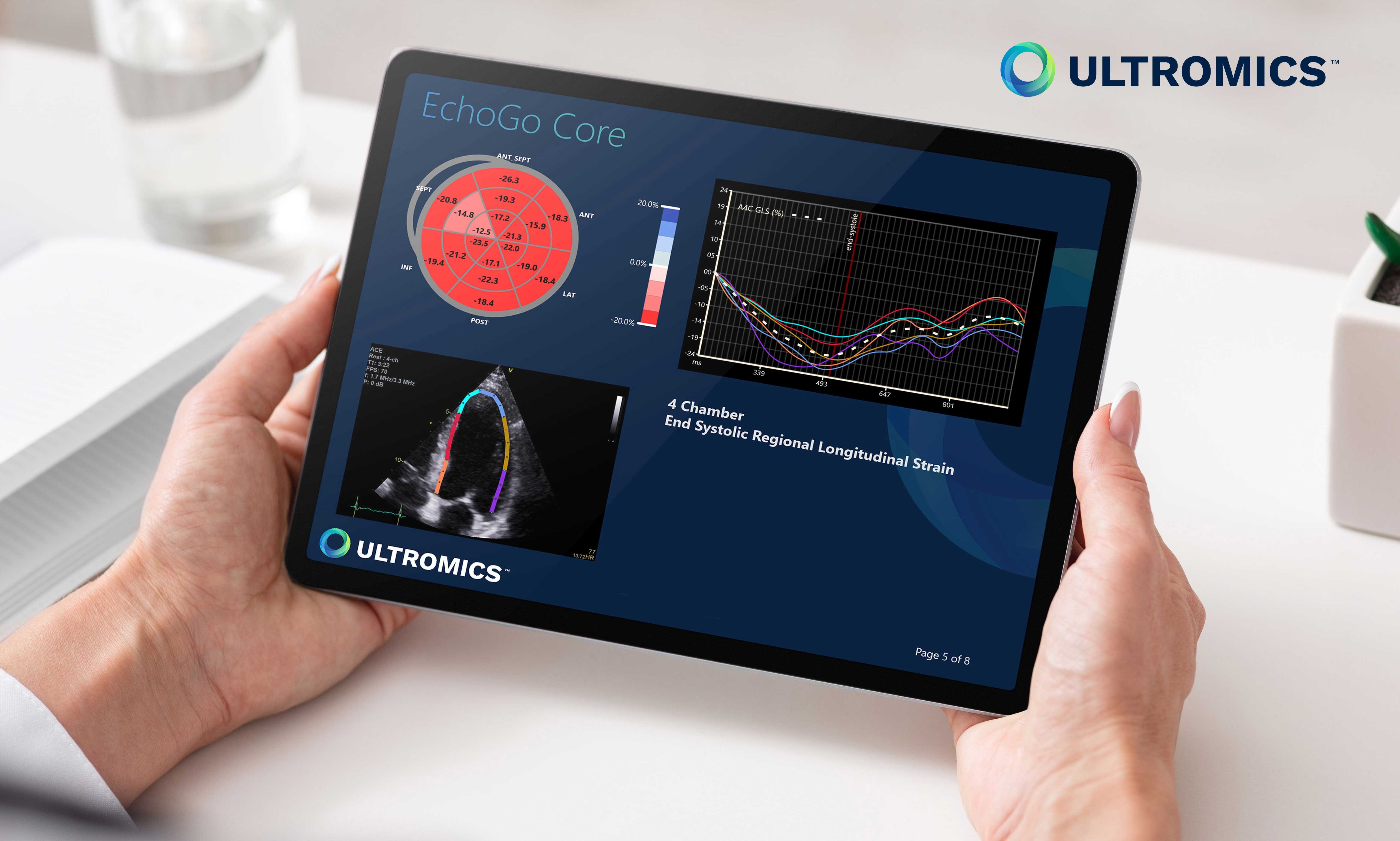 Two hands holding a tablet that displays a view of an echocardiogram