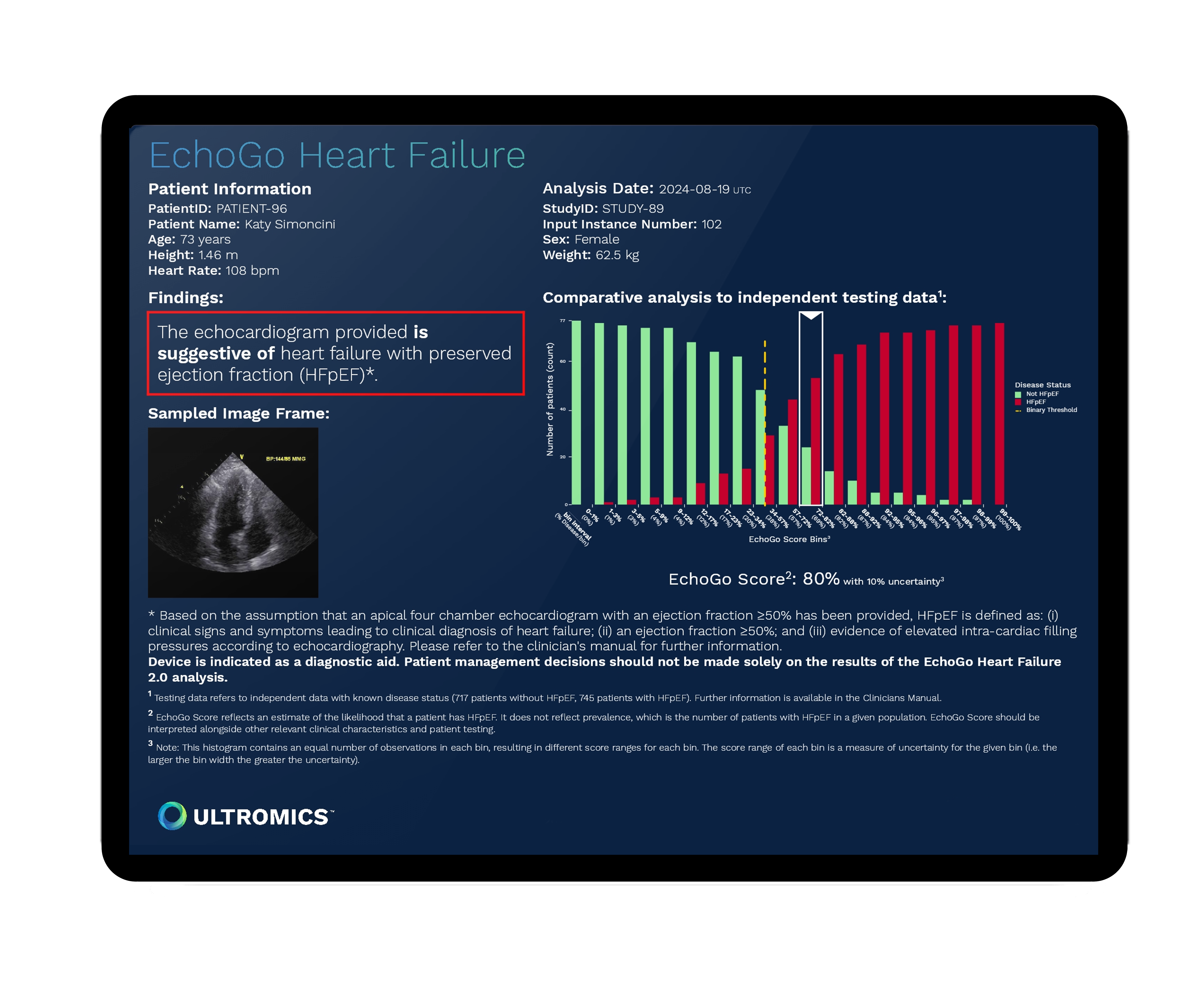EchoGo-HF-V2-Report-With-Scren-Glare-2025-01-08