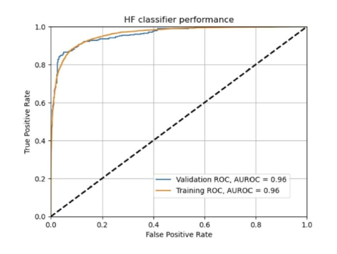 HFpEF report: Ultromics’ AI-derived measurements detects HFpEF with 96% accuracy. Study results discussed at ASE 2021 by Dr. Patricia A. Pellikka, from Mayo Clinic.