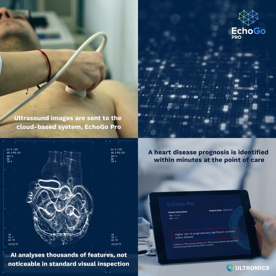 Ultromics CE mark's EchoGo Pro | Ultromics