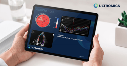 EchoGo Core by Ultromics. Report of Strain analysis shown on a tablet.