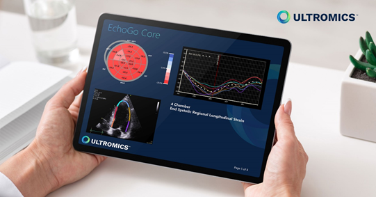 A pair of hands holding a tablet displaying Strain report from EchoGo