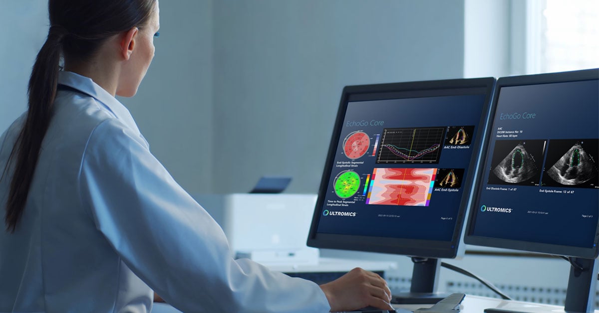AI outperforms human analysis in predicting cardiac outcomes, research initiative by WASE finds.