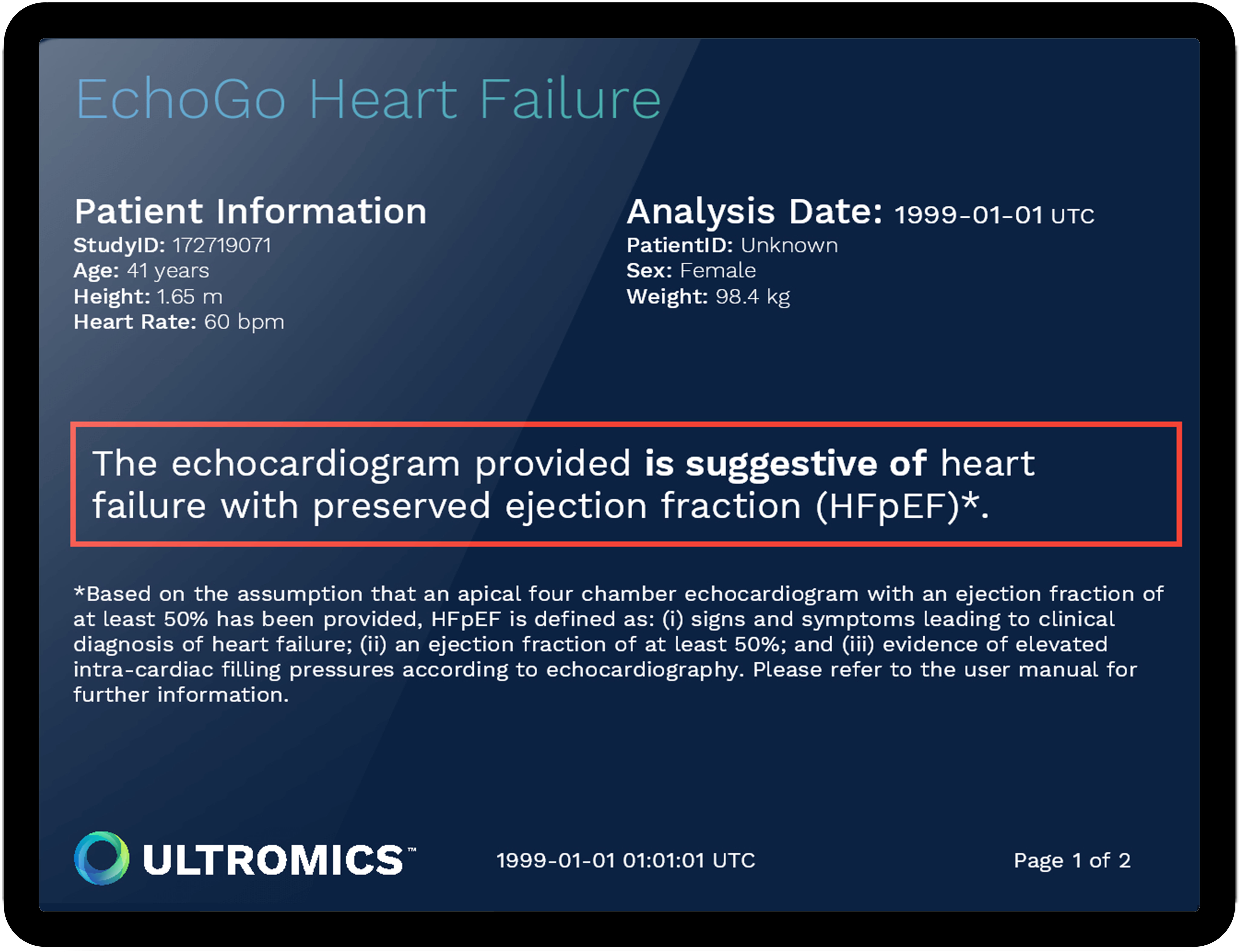 Next-generation Echocardiography is here - Ultromics