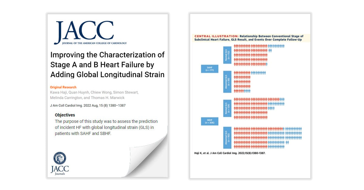 Global longitudinal strain (GLS)