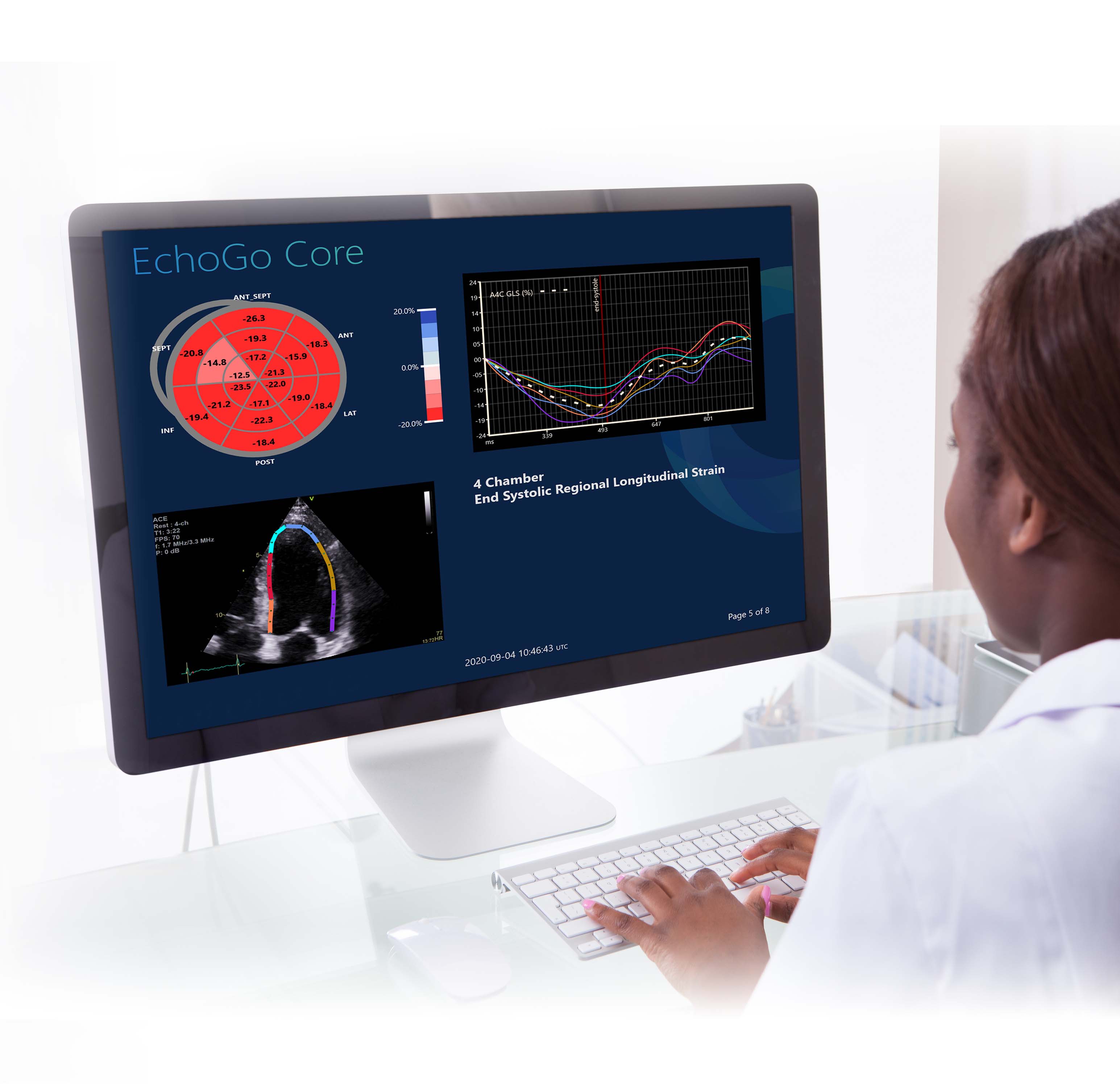 Ultromics - AI Enabled Cardiovascular Imaging Solutions